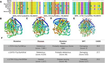 Case Report: Variations in the ALPL Gene in Chinese Patients With Hypophosphatasia